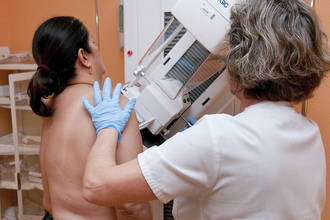 Arranca la campaña de cribado de cáncer de mama para la detección precoz de la enfermedad