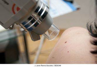 El Hospital de Guadalajara acogerá una jornada para detectar el cáncer cutáneo