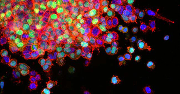 Investigadores españoles desarrollan el primer fármaco del mundo que bloquea la metástasis