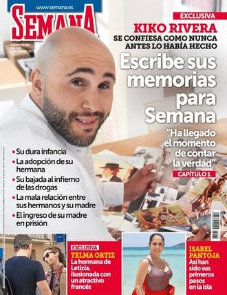 SEMANA Carlos Lozano debe cuidar su injerto capilar en Supervivientes