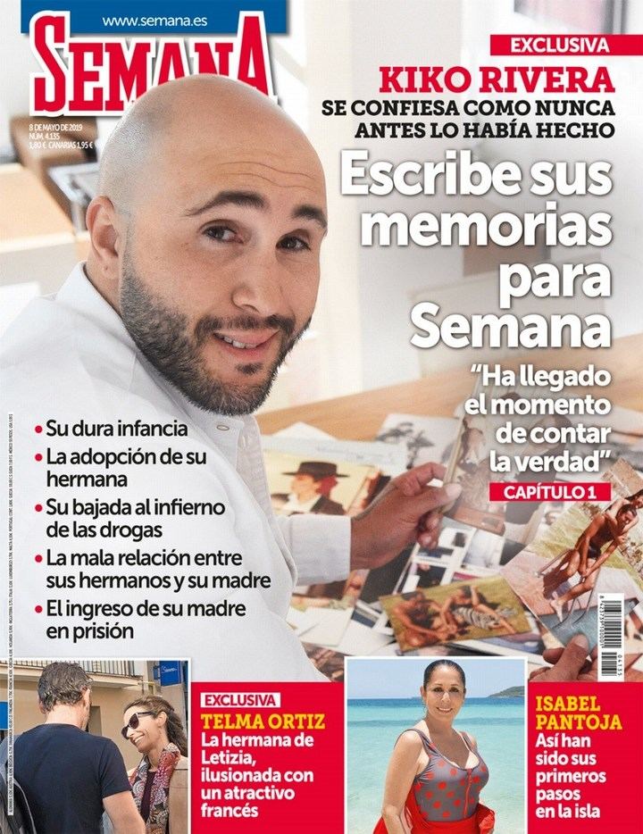 SEMANA Carlos Lozano debe cuidar su injerto capilar en Supervivientes