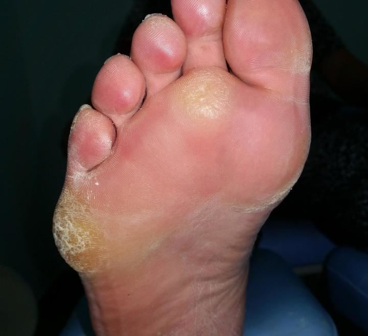 El Colegio de Podólogos de Castilla-La Mancha critica la formación online impartida por la Junta socialista de Page