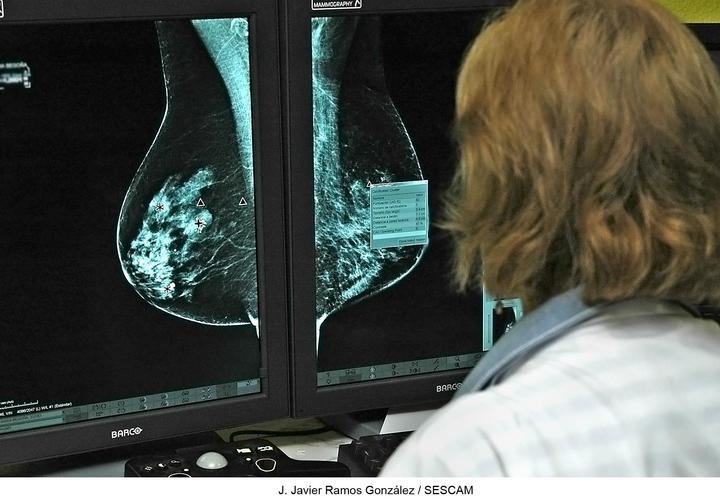 El programa de detección precoz de cáncer de mama alcanza en la provincia de Guadalajara su máxima participación, con más del 80%