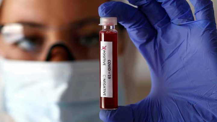 Primeros 3 fallecidos por coronavirus en Guadalajara que con los 54 nuevos casos de hoy ya registra 205 personas afectadas