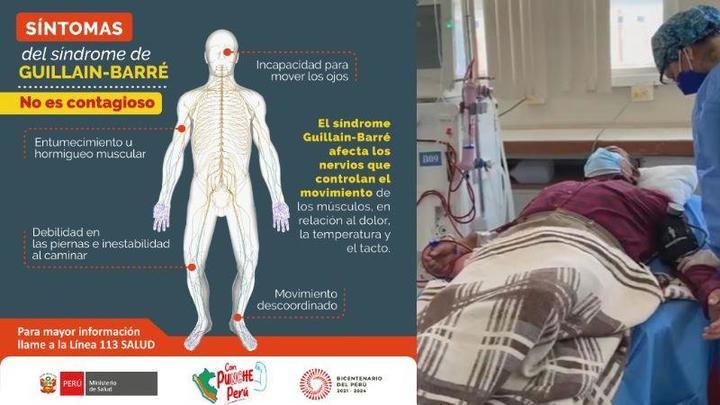 Así es el síndrome de Guillain-Barré por el que Perú ha decretado emergencia sanitaria nacional