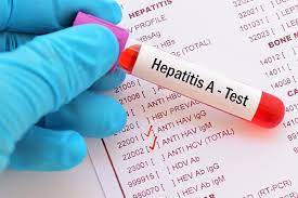 Alerta sanitaria por la detección de hepatitis A en fresas procedentes de Marruecos