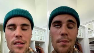 Justin Bieber vuelve a sonreír tras sufrir una parálisis facial