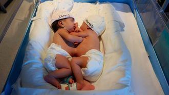 El Hospital Sant Joan de Déu de Barcelona se prepara para separar a dos bebés siamesas llegadas de Mauritania