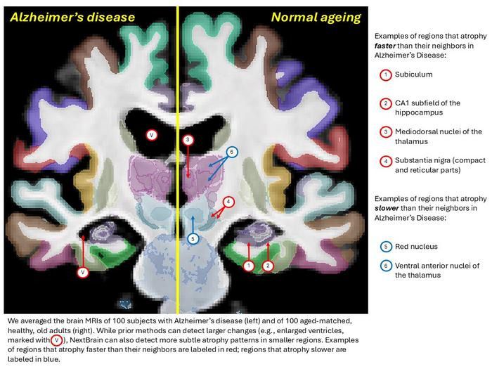 Un atlas asistido por IA representa el cerebro humano con un detalle sin precedentes