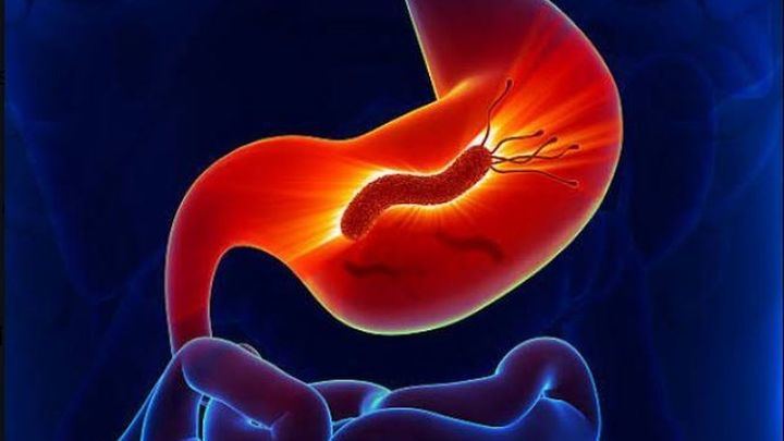 La bacteria Helicobacter pylori podría originar 11,8 millones de cánceres de estómago