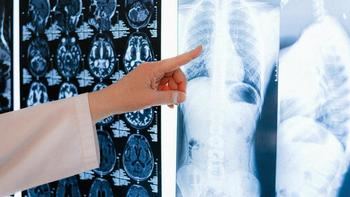 El cáncer, la principal causa de muerte en España en 2024 con más de 115.000 fallecidos