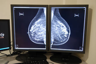 El Gobierno de Page revela ahora que dejó sin citar a casi 8.000 mujeres para mamografías en Talavera