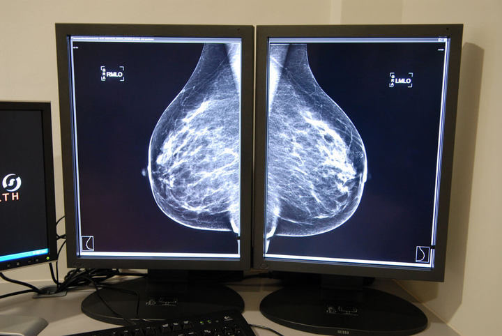 El Gobierno de Page revela ahora que dejó sin citar a casi 8.000 mujeres para mamografías en Talavera