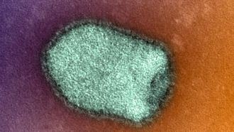 Muere el paciente aislado por rabia tras ser mordido por un perro en África