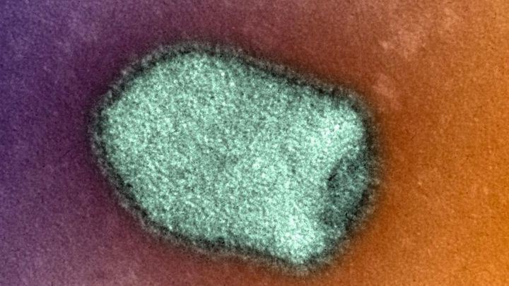 Muere el paciente aislado por rabia tras ser mordido por un perro en África