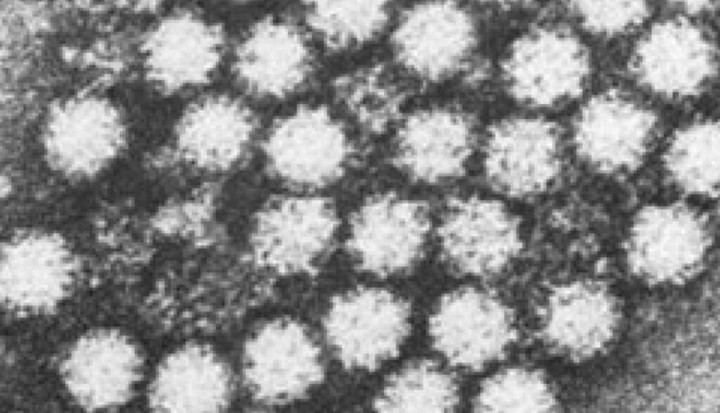 Nueva variante del norovirus impulsa brotes de gastroenteritis a nivel global