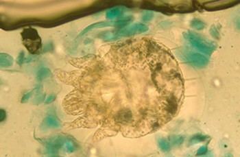 Aumentan significativamente los casos de sarna en España, según estudio del ISCIII