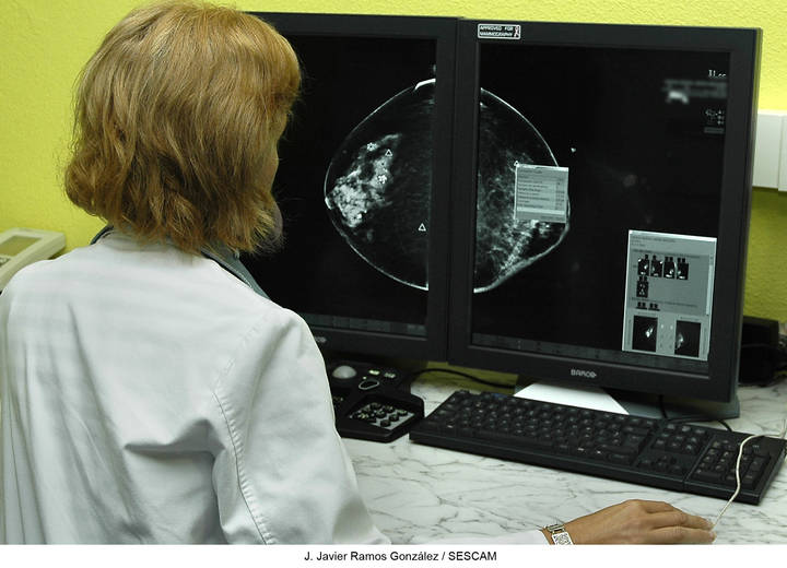 El valor predictivo negativo de las biopsias de cáncer de mama realizadas en el Hospital es superior al 95%