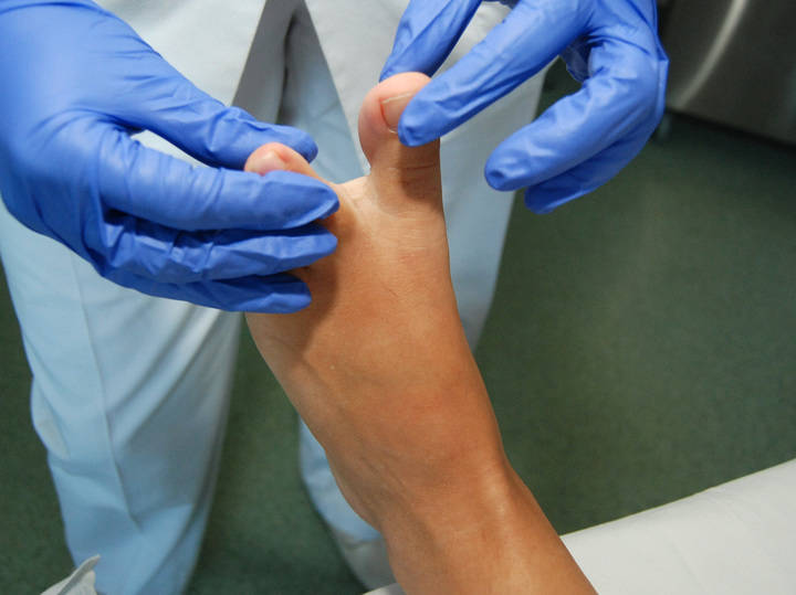 El SESCAM ha ofrecido más de 5.300 tratamientos podológicos gratuitos a pacientes diabéticos