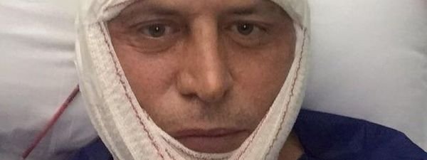 Así ha quedado Kiko Matamoros tras su operación facial