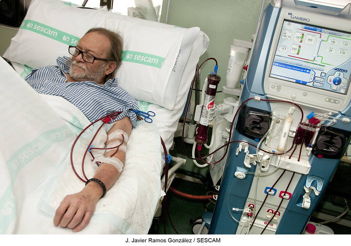 Durante el pasado año, 15 pacientes de Guadalajara recibieron un trasplante de riñón