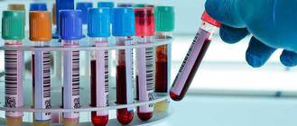 El próximo 10 de junio comenzará a funcionar el servicio de extracción de sangre de Valdeluz